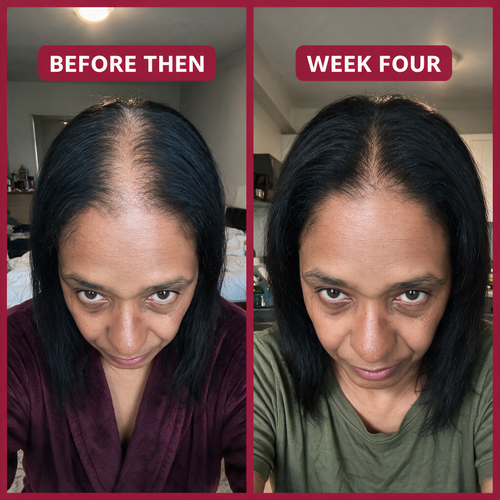 Rice Water X Rosemary Scalp Serum